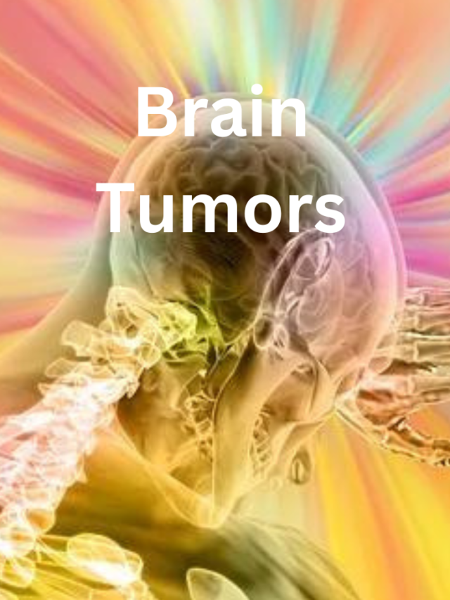 Brain Tumors: A Comprehensive Guide